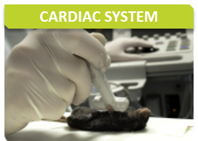 Cardio_Titre_Cardiac system