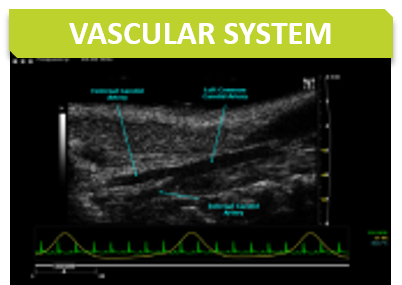 Cardio_Titre_Vascular system