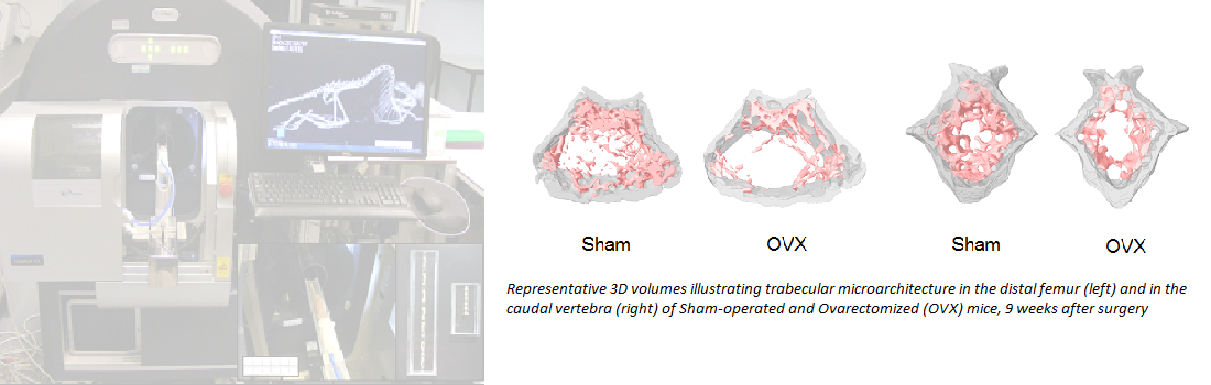 Metabo_Bone analysis