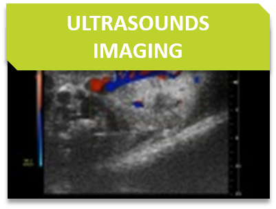 Imaging_Titre_Ultrasounds