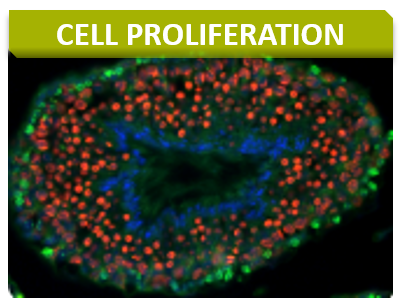 Anapath_Titre_Cell proliferation