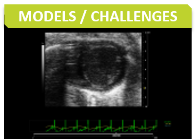 Cardio_Titre_Models challenges
