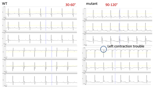 Cardio_Multiderivational ECG image