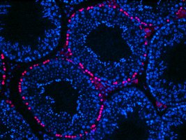 Anapath_CellProliferation_1