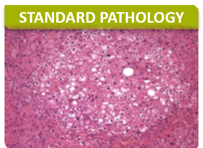 Anapath_Titre_Standard Pathology