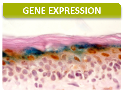 Anapath_Titre_Gene expression