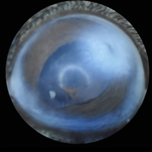 Behavior_Slit lamp 4 imaging