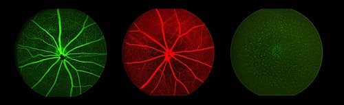 Behavior_Angiography imaging