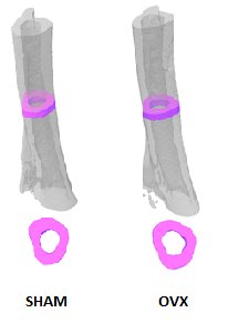 Imaging_Bone dynamics microCT Tibia